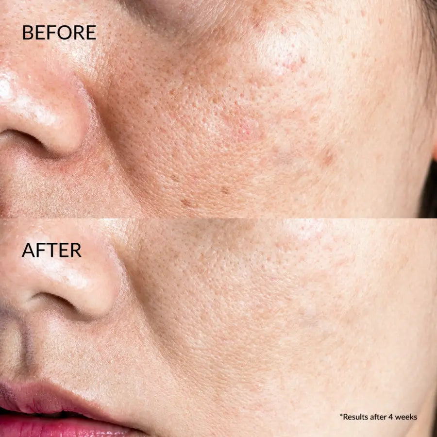 IREN Shizen Star Light 20ml – Japán ragyogást fokozó arcszérum Yuzuval, Alpha-Arbutinnal és Niacinamiddal | Pigmentfoltok halványítása és egységes bőrtónus természetesen
